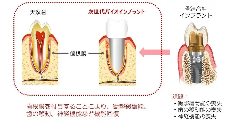 【株式会社オーガンテック】 次世代バイオインプラント、FDA申請で米企業と提携