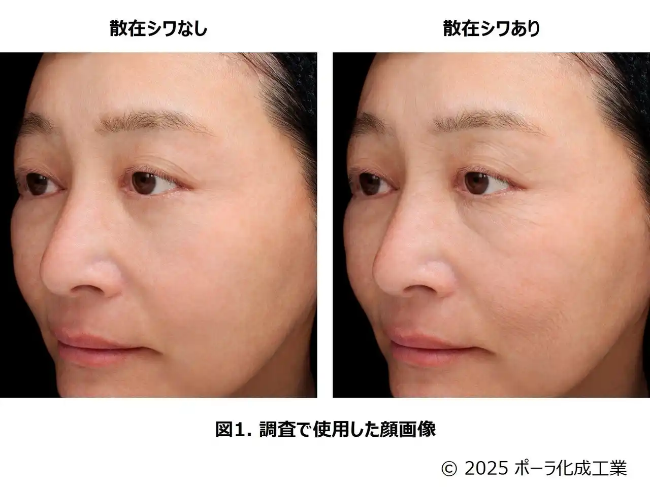 【ポーラ・オルビスHD】 シワができると認識されていない部位のシワに着目「散在シワ」による肌やその人の印象への影響を発見