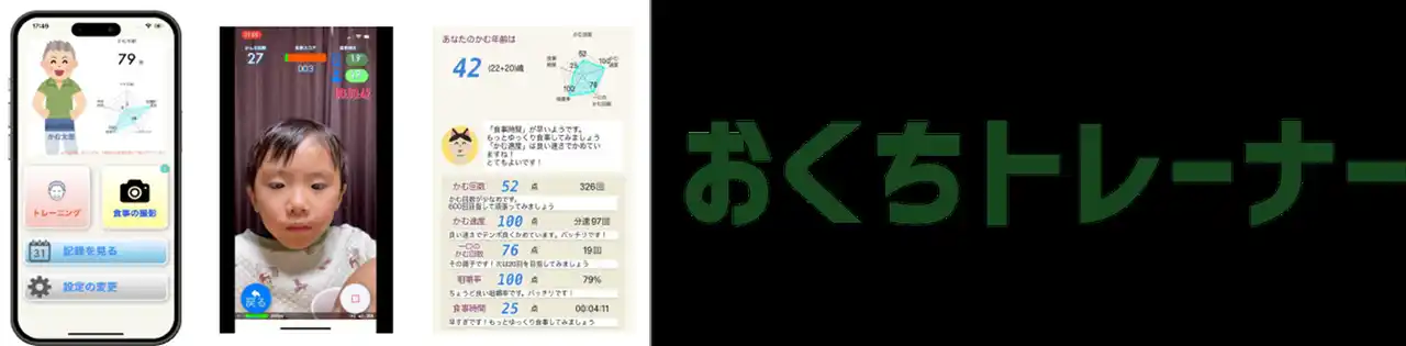 口腔機能トレーニングアプリ『おくちトレーナー』歯科人工知能研究会にて共同研究成果発表