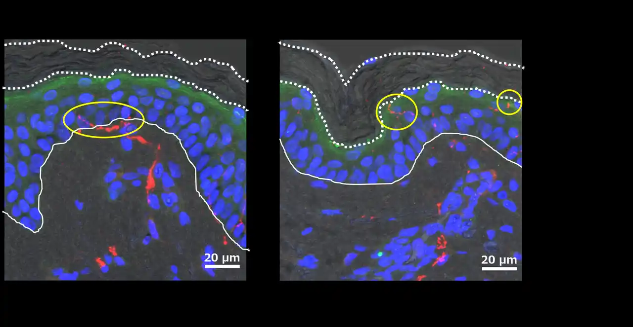 【花王株式会社（ニュースリリース）】 敏感肌における知覚過敏のメカニズムの一因を明らかに