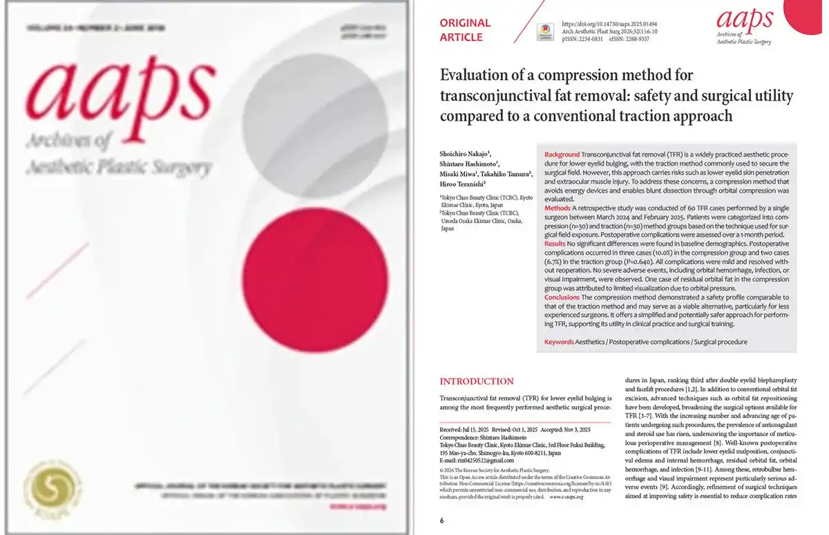 TCB中上勝一朗医師らの研究が国際学術誌「Archives of Aesthetic Plastic Surgery」に掲載。経結膜脱脂術における新アプローチ"圧迫法"の安全性と有用性を検証。