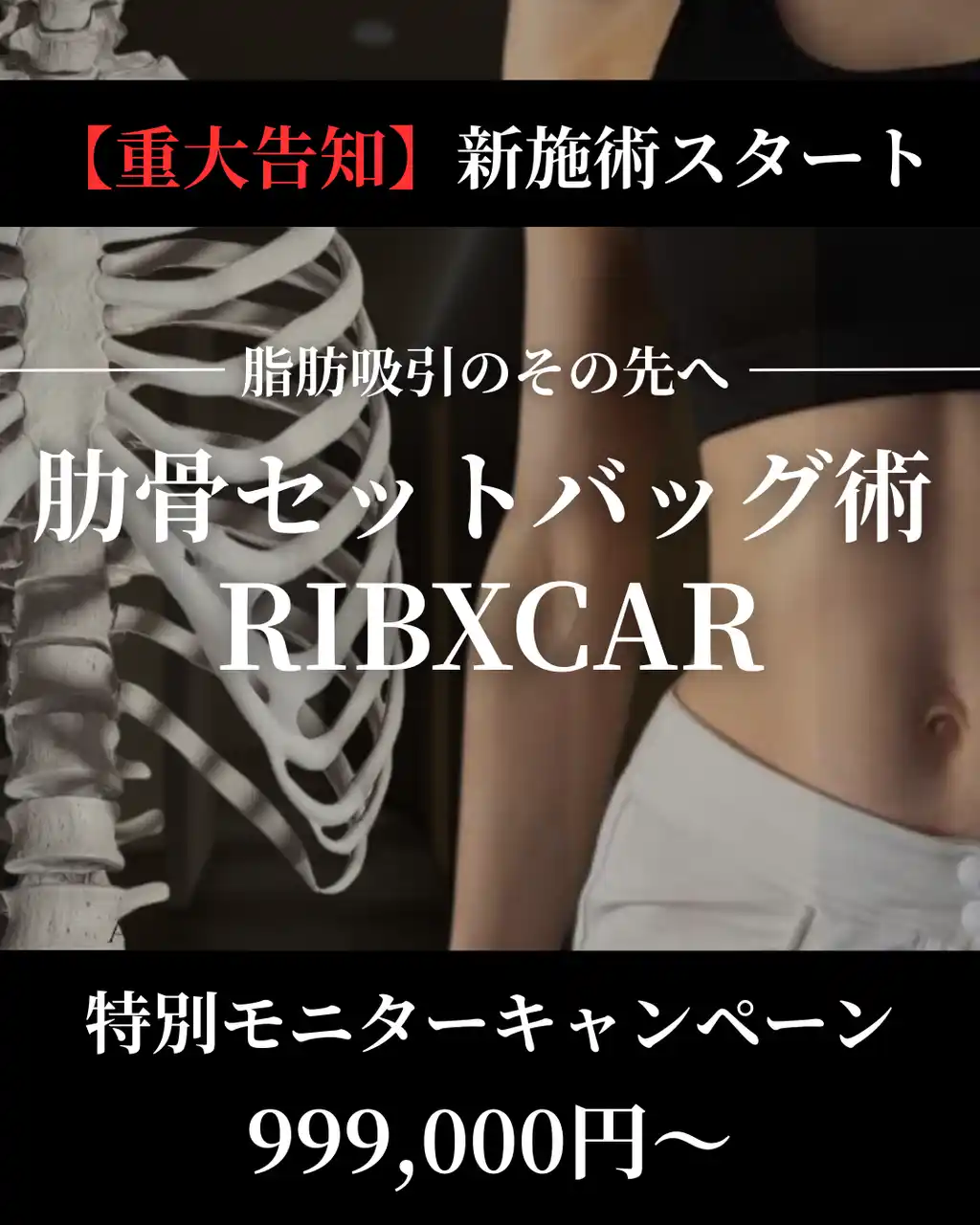 【AVAN TOKYO 銀座脂肪吸引クリニック】新施術「肋骨セットバッグ術（RIBXCAR）」導入 ～特別キャンペーンモニター開始～