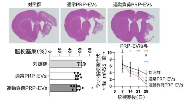 【学校法人 順天堂】 脳梗塞後の回復を促す新たな治療法の可能性