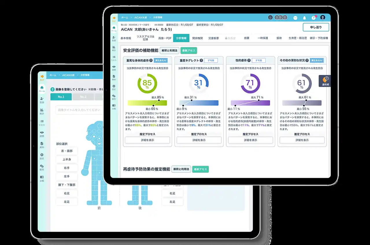 【株式会社AiCAN】StartX × JETRO のアクセラプログラムに採択