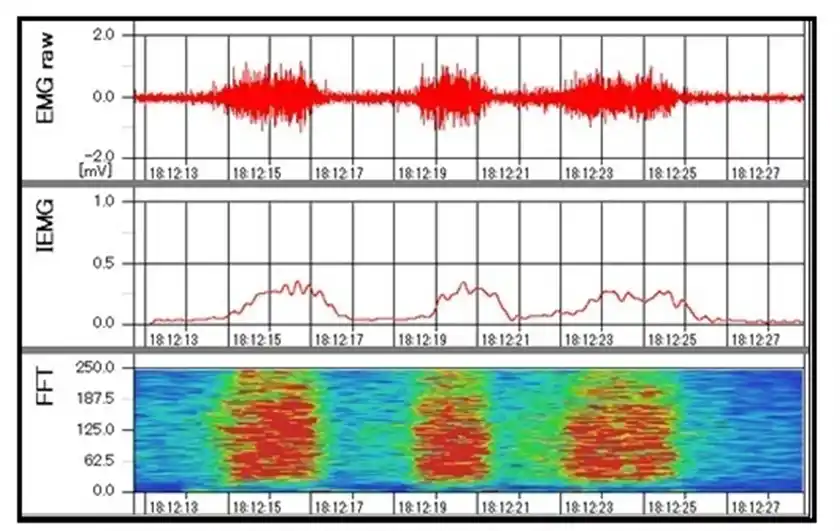 運動中の実際の計測データ