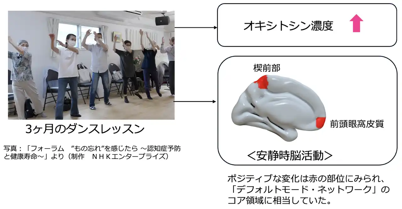 【研究成果】3ヶ月のダンスで高齢者の脳活動が変化