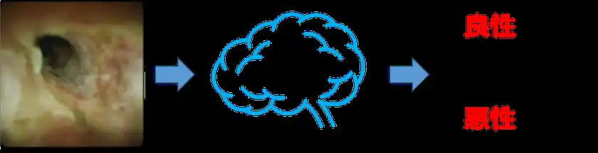 図2：AIによる胆道鏡画像の良悪性診断支援のイメージ