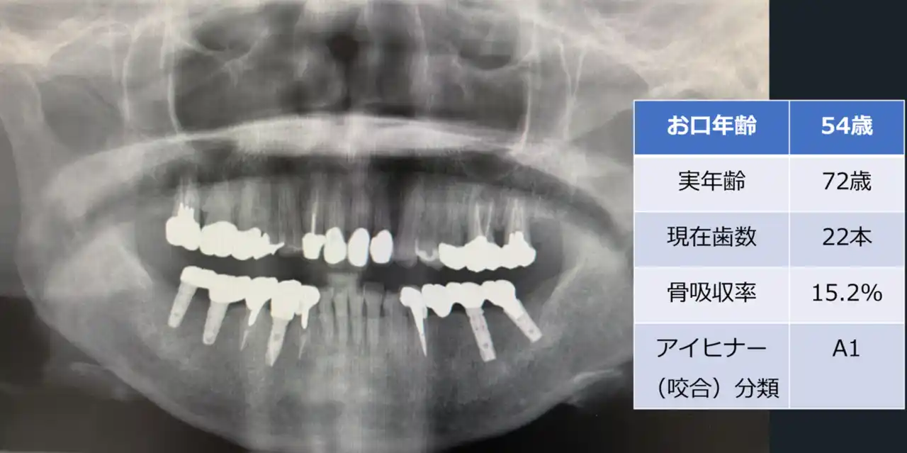 【医療法人社団 葵会】 歯科エックス線画像を用いた「お口年齢AI」の開発について by PR TIMES
