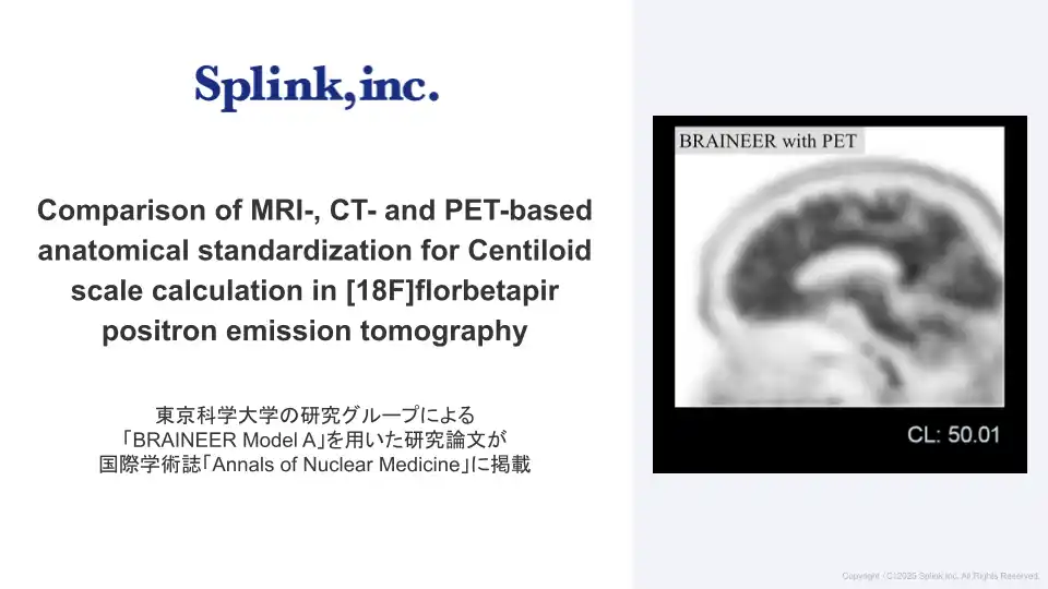 【株式会社Splink】 論文掲載：東京科学大学の研究グループによる「BRAINEER Model A」を用いた研究論文が国際学術誌「Annals of Nuclear Medicine」に掲載されました