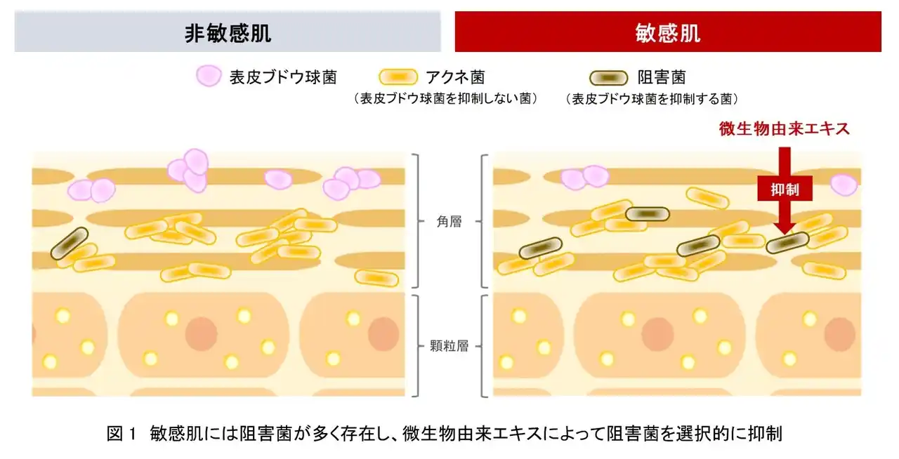 【株式会社資生堂】 資生堂、菌叢研究を通じて敏感肌には表皮ブドウ球菌の生育を阻害する特殊なアクネ菌が多いことを発見　～特殊なアクネ菌を選択的に抑制する効果を微生物由来エキスに発見～