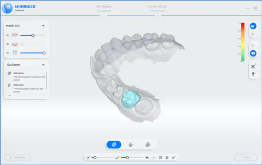 デジタルデンチャーの製作背景